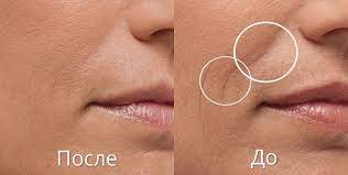 Masáž obličeje a oblasti nosu