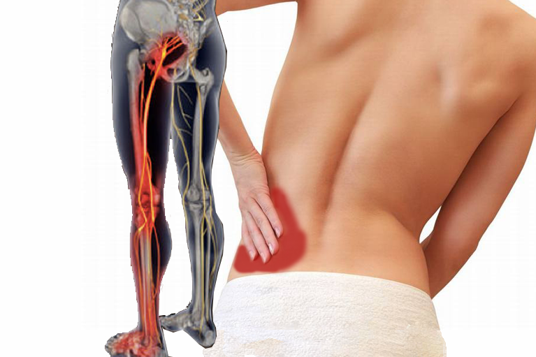 Боль в ногах - причины мышечной боли и тяжести в ногах, диагностика и лечение